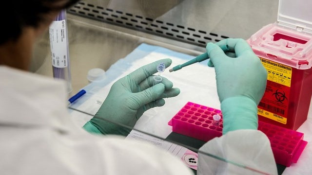 Imagem de Covid-19: Portugal recebeu 900 mil testes, mas faltam kits para os realizar