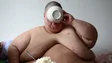 Imagem de Obesidade é epidemia na Europa agravada pela pandemia
