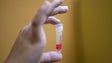 Covid-19: Portugal vai fazer testes de imunidade, diz DGS