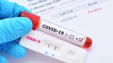 Imagem de Covid-19: Portugal regista hoje mais três mortos e 388 novos casos de infeção