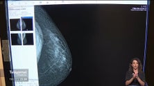 Imagem de Rastreio do cancro da mama em Santa Cruz (vídeo)