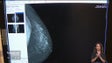 Imagem de Rastreio do cancro da mama em Santa Cruz (vídeo)