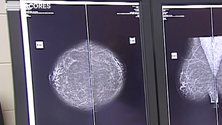 Imagem de Dia Mundial do Cancro (Vídeo)