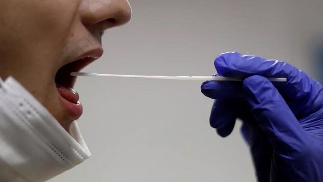 Imagem de Centro Europeu admite testes PCR com saliva