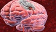 Imagem de Unidade de Doenças Cerebrovasculares abre este mês no Hospital Central do Funchal