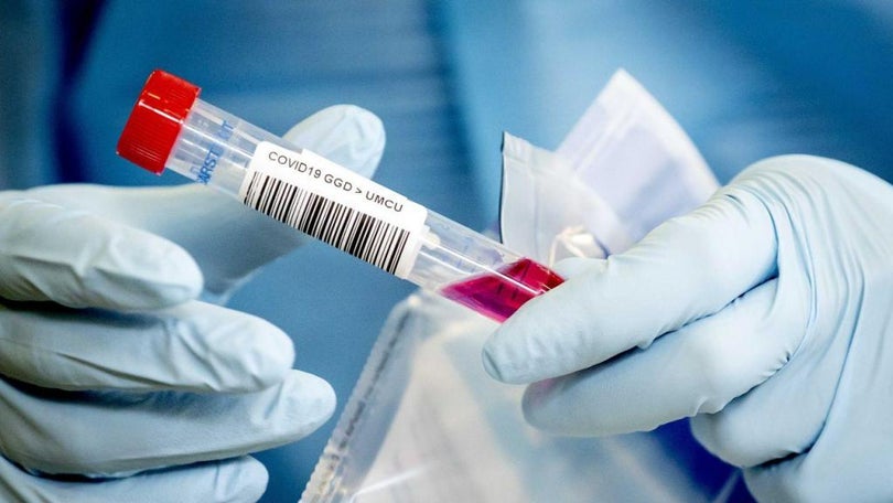 Imagem de Covid-19: Portugal com mais 13 mortos e 734 novos casos