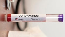Imagem de Covid-19: Número de doentes recuperados cresce mais de 50% em Portugal