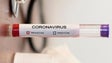 Imagem de Covid-19: Número de doentes recuperados cresce mais de 50% em Portugal