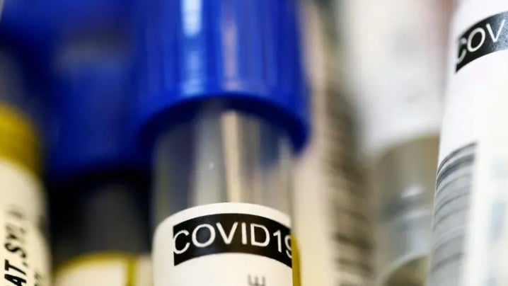 Imagem de Investigadores portugueses estudam potencial vacina oral