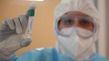 Imagem de Covid-19: Mais 79 mortes e 6.049 novos casos
