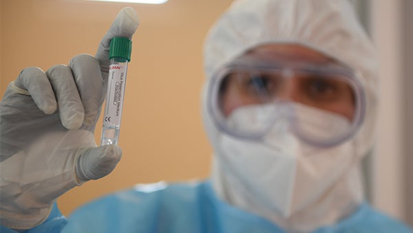 Imagem de Covid-19: Mais 79 mortes e 6.049 novos casos
