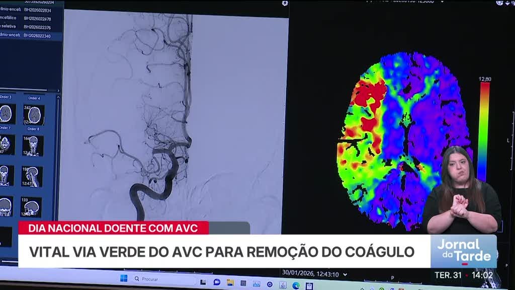 Dia nacional do doente. AVC mata mais de dez mil pessoas por ano