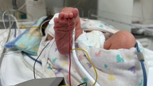 Imagem de Nove por cento dos bebés que nascem anualmente na Região são prematuros (áudio)