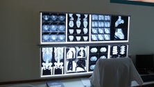 Imagem de AMI apela à reciclagem de radiografias