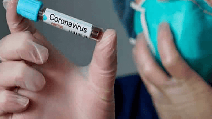 Imagem de Covid-19: Portugal regista hoje dois mortos e 418 novos casos de infeção