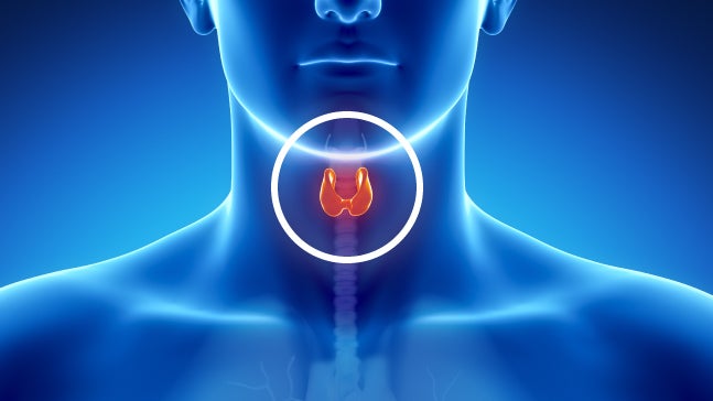 Doença autoimune e hipertiroidismo podem aumentar risco de cancro da tiroide