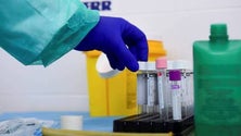 Imagem de Covid-19: Reino Unido aprova primeiro teste serológico