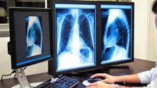 Imagem de Exames médicos vão poder ser consultados online (Vídeo)