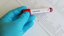 Imagem de Surto de Legionella no norte: 27 internados e duas mortes