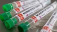 Portugal vai receber 2.700 doses das vacinas adquiridas por Bruxelas