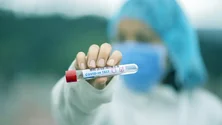 Imagem de Covid-19: Alemanha ultrapassa 160 mil casos diagnosticados