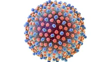 Imagem de Madeira tem identificados 700 casos de Hepatite C