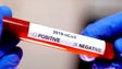 Imagem de Covid-19: Madeira tem 54% dos doentes recuperados (Vídeo)