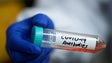 Imagem de Covid-19: Portugal inicia colheita de plasma de sangue de doentes recuperados