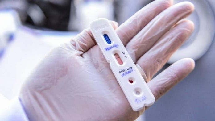 Imagem de Lucro máximo de 15% na venda de autotestes