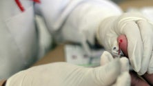 Imagem de Cancro responsável por 20% das mortes e infeções por VIH
