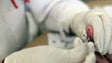 Imagem de Cancro responsável por 20% das mortes e infeções por VIH