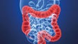 Imagem de Cancro mata muitos portugueses (vídeo)
