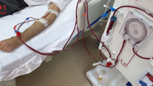 Imagem de Madeira avança com estudo sobre doença renal crónica