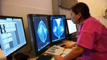 Imagem de Cancro é a doença que mais preocupa portugueses