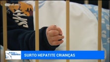 Imagem de Especialistas em alerta com surto de hepatite aguda em crianças (vídeo)