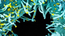 Imagem de Cientistas impedem replicação do Coronavírus nas células humanas