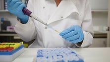 Imagem de Nova imunoterapia com origem portuguesa está a ser testada nos EUA