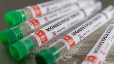 Imagem de Monkeypox: Número de casos sobe para 96 em Portugal