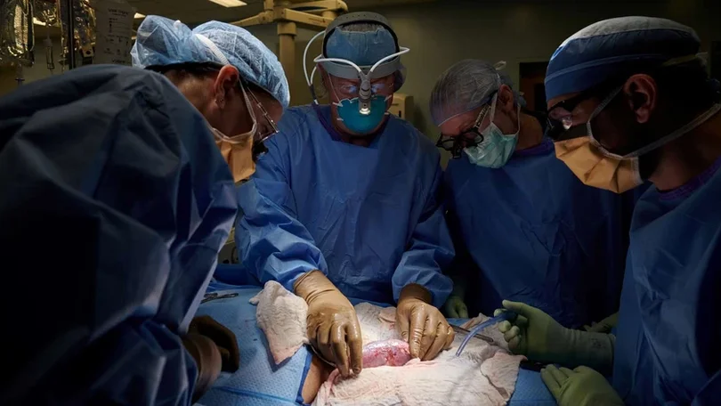 Imagem de Experiência de rim de porco em humano termina com recorde de dois meses em funcionamento
