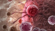 Imagem de Cancro em discussão na ilha de Santa Maria (Vídeo)