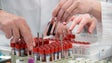 Imagem de Análise de sangue pode vir a detetar cancro em pessoas ainda sem sintomas