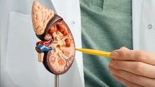 Imagem de Descoberto método que pode permitir diagnóstico precoce do cancro renal
