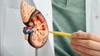Imagem de Descoberto método que pode permitir diagnóstico precoce do cancro renal
