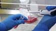 Imagem de Covid-19: Consórcio propõe terapia inovadora para eliminar o vírus em segundos
