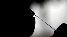 Imagem de Covid-19: Investigadores descobrem marcador que antecipa prognóstico