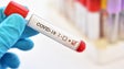 Covid-19: Portugal regista mais quatro mortes e 406 novos casos de infeção