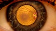 Imagem de O serviço de Saúde da Madeira já realizou mais de 19 mil exames à retinopatia
