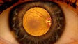 O serviço de Saúde da Madeira já realizou mais de 19 mil exames à retinopatia