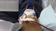 Imagem de Cinquenta aguardam por um transplante de rim (vídeo)