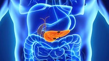 Imagem de Cancro do pâncreas mata mais nos Açores (Som)